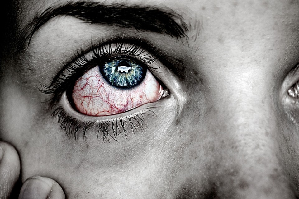 Синдром сухого глаза – правильно ли мы его лечим?
